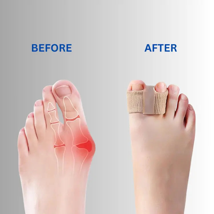 Silicone Toe Separator Set – Soft Correction & Pain Relief