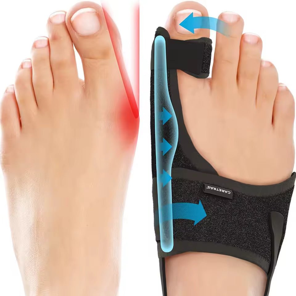 Adjustable Toe Splint for Night – Ergonomic Correction for Left and Right