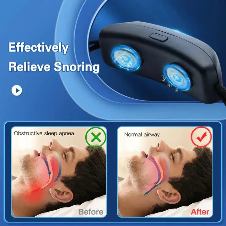 Anti-Snoring Device EMS Pulse Technology Rechargeable Comfortable for Quiet Sleep Breathing Aid Adjustable Intensity Portable Design | Sansoti