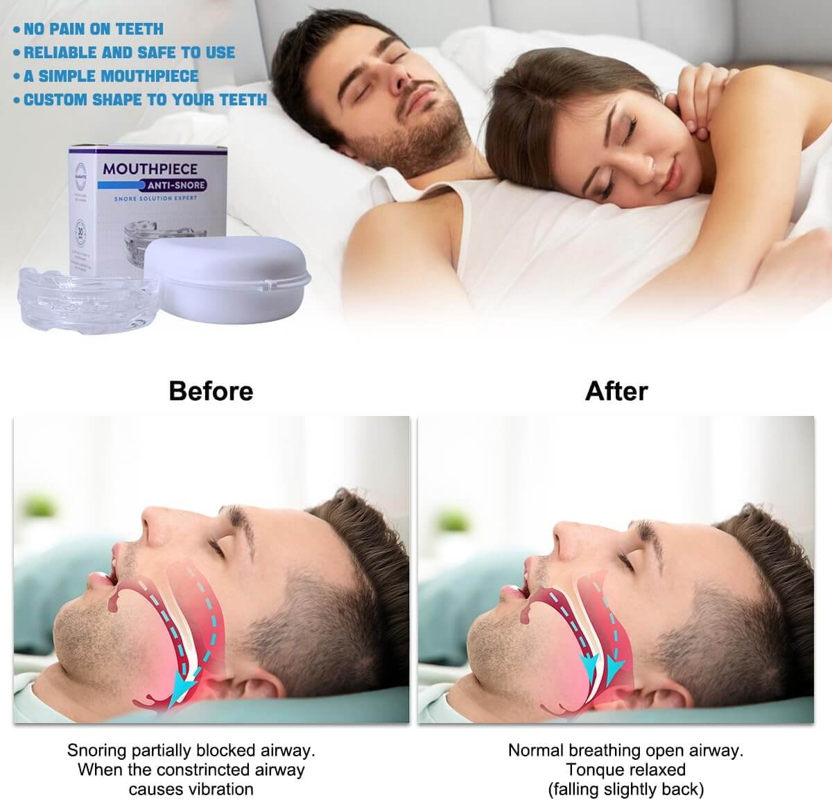 Anti-Snoring Mouthpiece, Single or Twin Pack